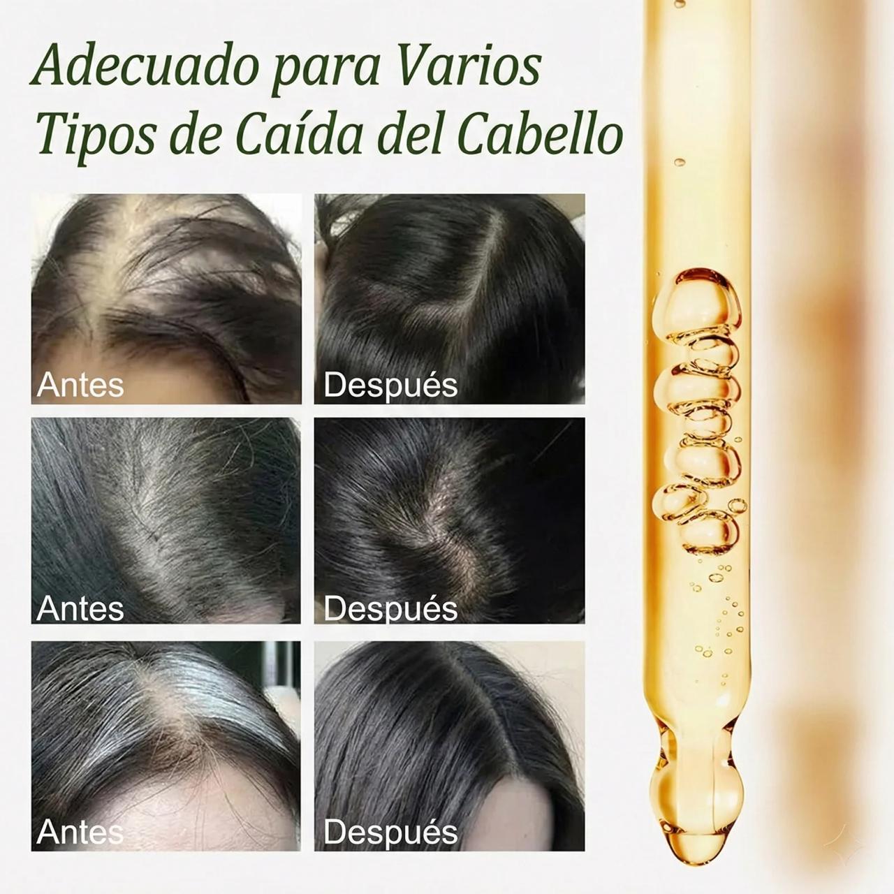 Aceite de Batana 100% Puro – Nutre, Fortalece y Estimula el Crecimiento del Cabello