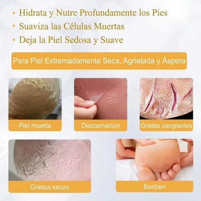 Aceite para Talones – Reparador y Suavizante de Talones Agrietados y Callosidades