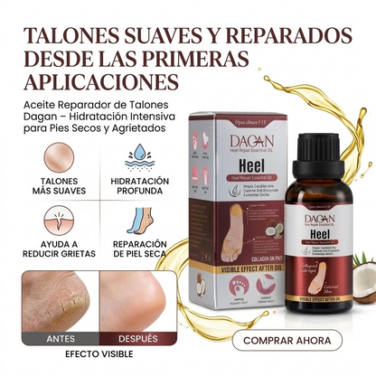 Aceite para Talones – Reparador y Suavizante de Talones Agrietados y Callosidades